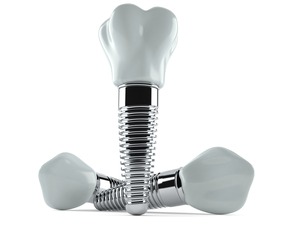 Close-up of three dental implants with crowns