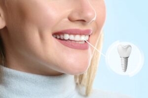 Woman smiling with a dental implant pictured. 